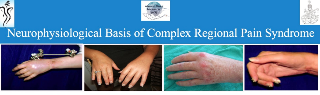 Neurophysiology of Comples Regional Pain Syndrome