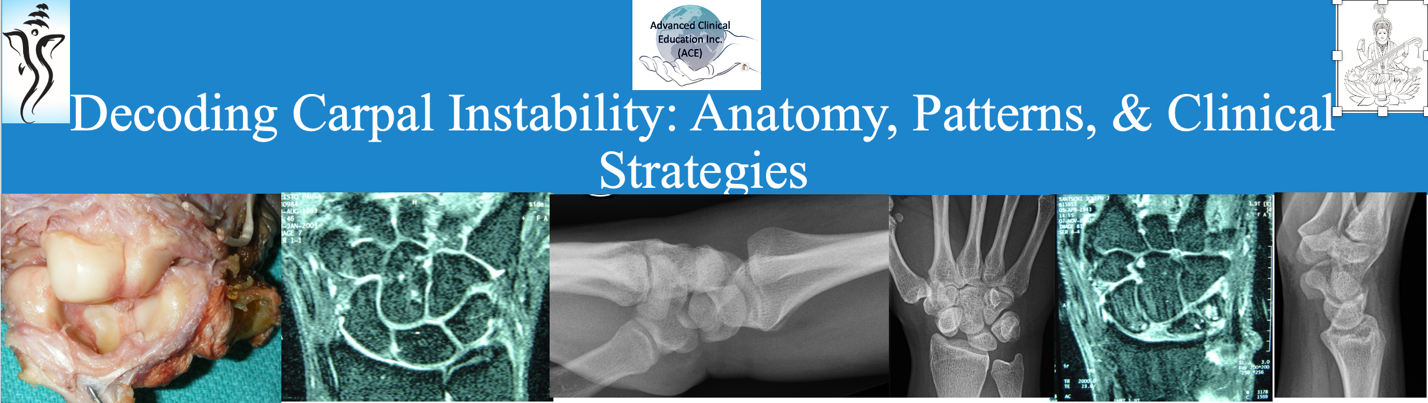 Decoding Carpal Instabilities: Anatomy, Patterns, & Clinical Strategies