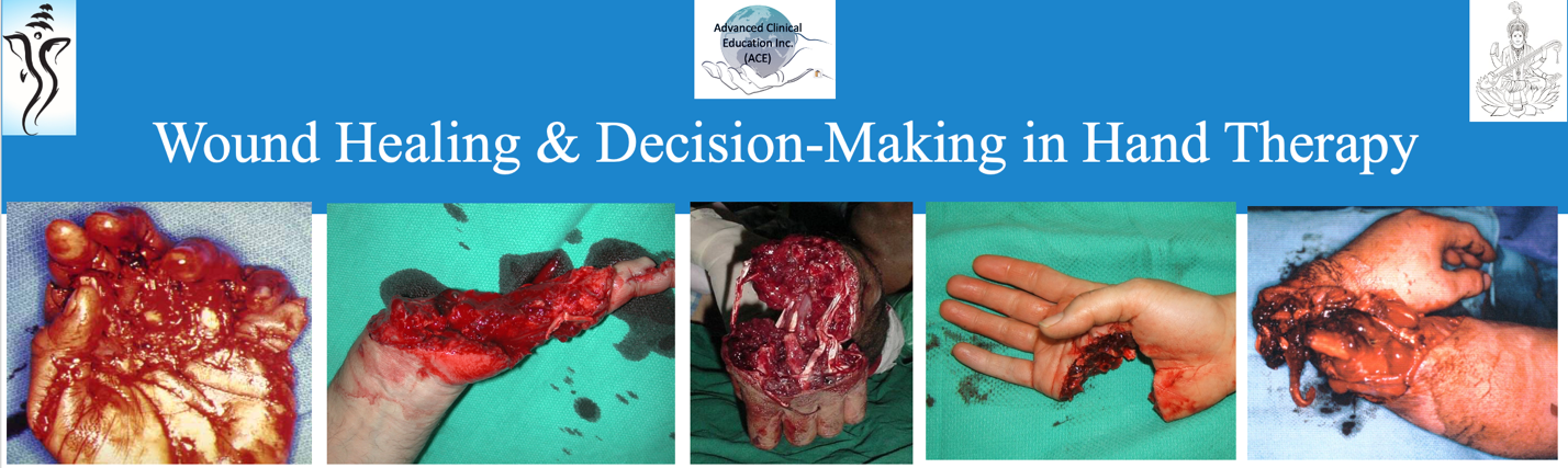 Wound Healing and Clinical Decision Making in Hand Therapy